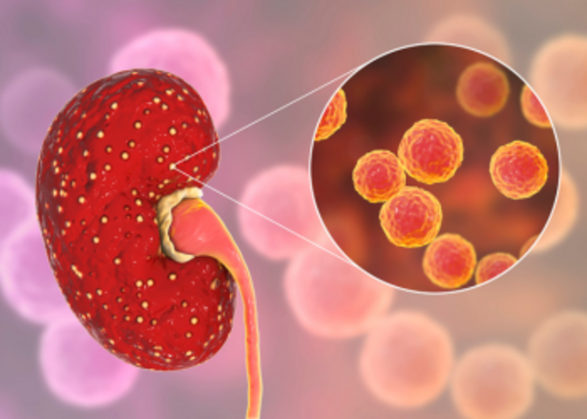 Recurrent Urinary Infections Prevention|Dr. Veena Chaudhari